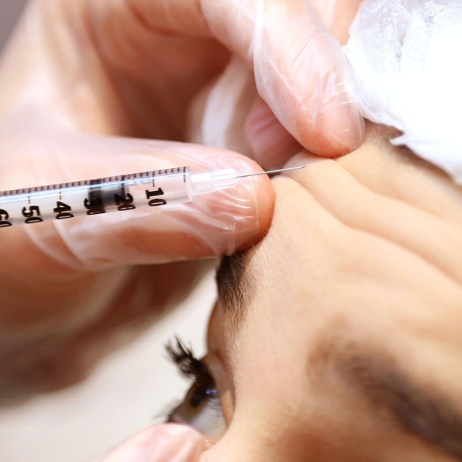 The Mayfield Clinic by Dr. Nestor -Facial botox and fillers